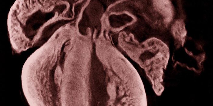 A Cause of Developmental Defects is Identified