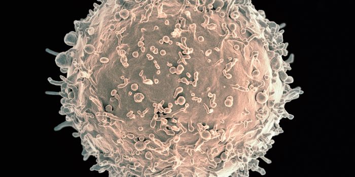 B Cells Contribute to Brain Lesions in Multiple Sclerosis