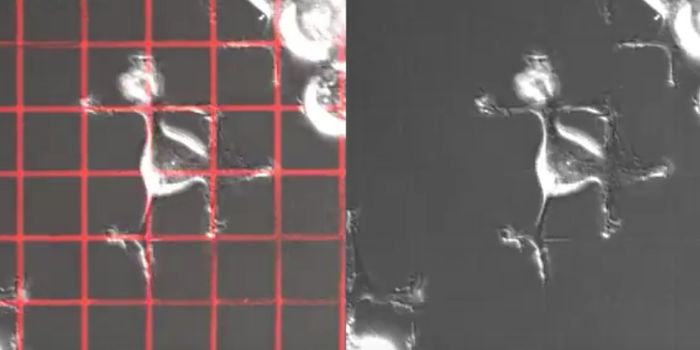 Stopping Cancer Cells in Their Tracks