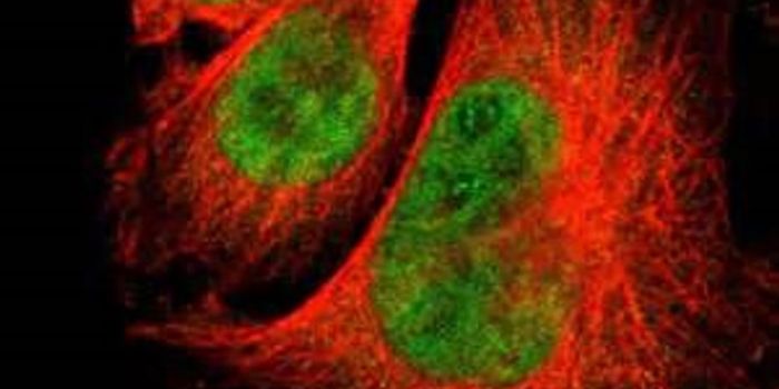 New Mechanism Found to Control Cell Response to DNA Damage