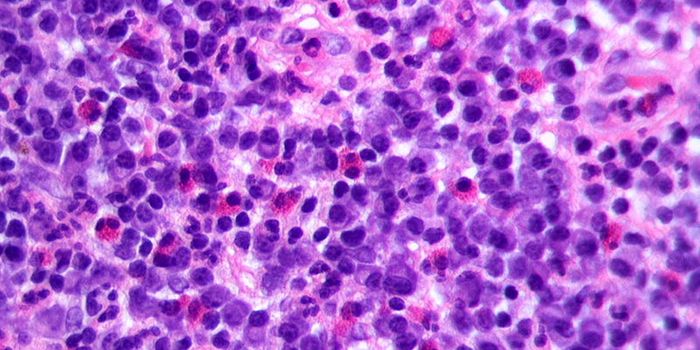 Immune Cell Transforms in the Blood Vessels of Obese People