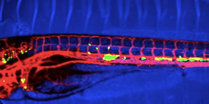 Zebrafish as Metastatic Cancer Model