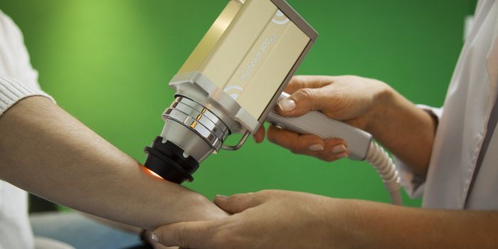 New Cell Marker Deletion Leads to Reduced Tumor Growth