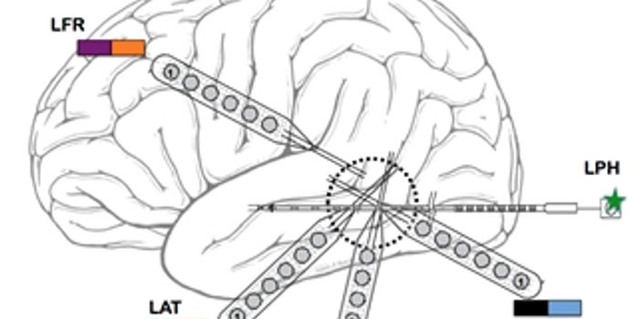 Penn to Lead $22.5 Million Project on Restoring Memory Loss