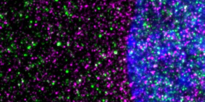 A Slowdown in Cells' Protein Construction Drives Huntington's