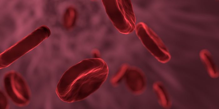 Looking to the Immune System for Help Diagnosing Carotid Stenosis