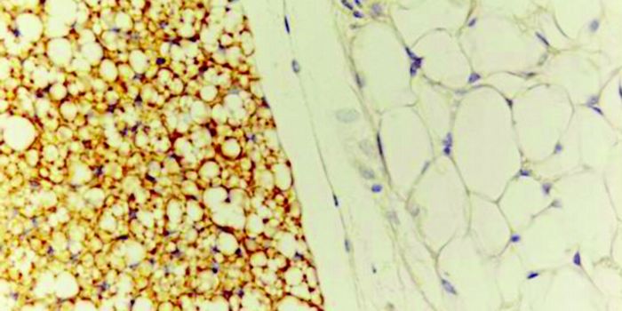 Alternative Pathway to Activate Brown Adipose Tissue