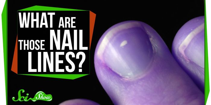 What are the white marks on my nails?