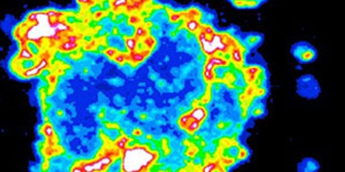 Exploring Clinical Potential of Microvesicles