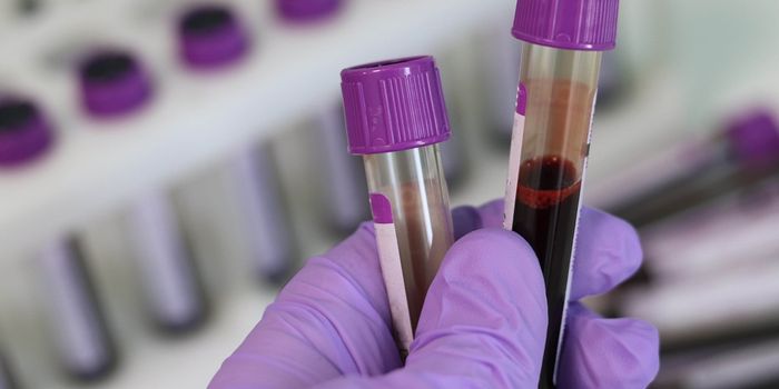 Prostate Cancer Mutation Screen Moves to the Clinic for Improved Treatment