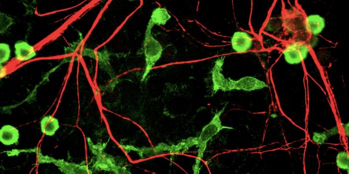 Using Stem Cells to Understand Autism