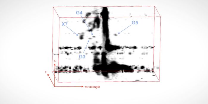 What Are Those Strange Objects Orbiting Sagittarius A*?