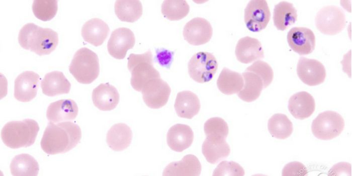 Malarial Organism Characteristics Leads Researchers To Potential Cancer Therapeutic Target