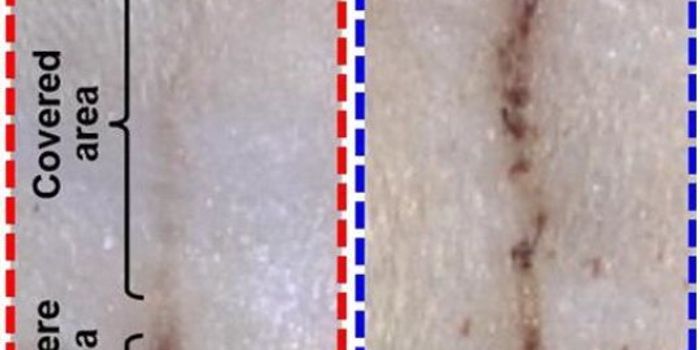 E-Bandages for Wound Healing