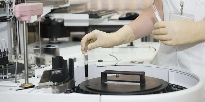 Mass Spectrometry and How It Can Profile Cancer