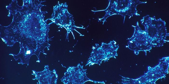 Genetic Cause for Tumor Progression