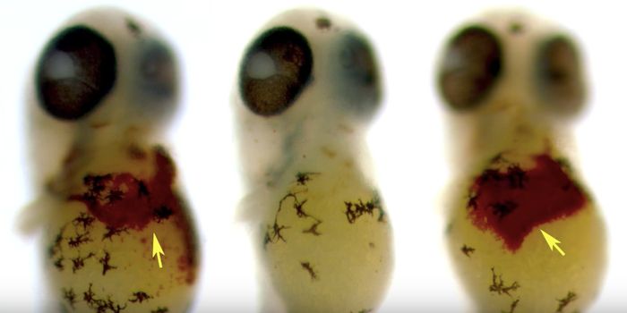 Natural Molecule May Aid in Treatment of Iron Disorders