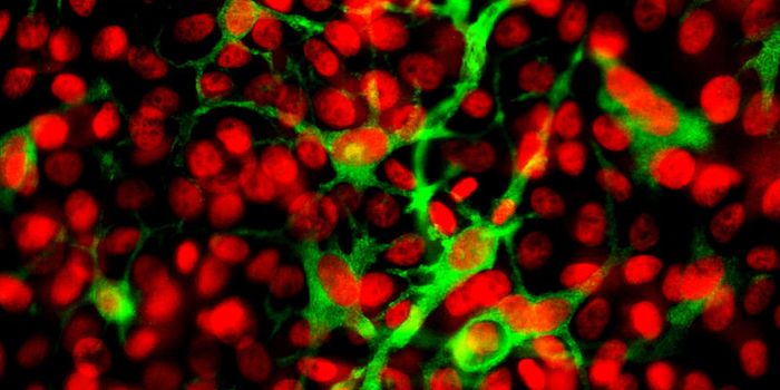 Monocyte Diversity Vital for Personalized Cancer Immunotherapy