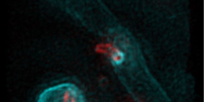 Mechanisms of Predatory Bacterium Revealed by Researchers