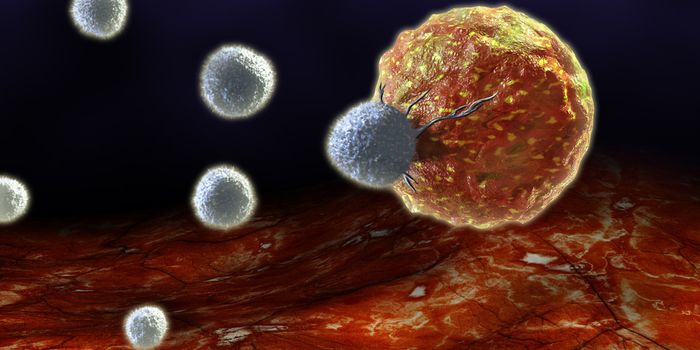 CAR T Cells Can Now Target Solid Tumors