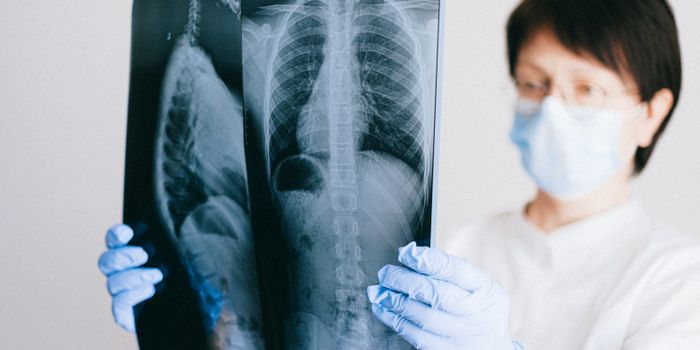 The FDA approves the first and only oral treatment for a certain non-small cell lung cancer.