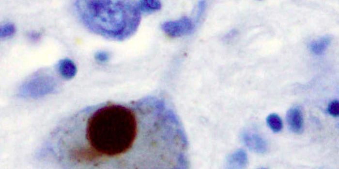 A Sniff Test for Parkinson's?