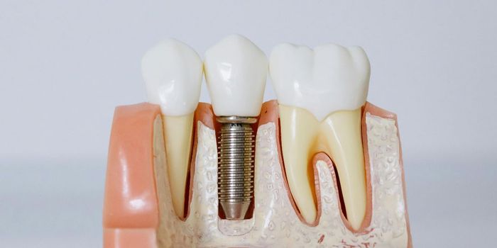 Gum Disease Linked to Brain White Matter Damage