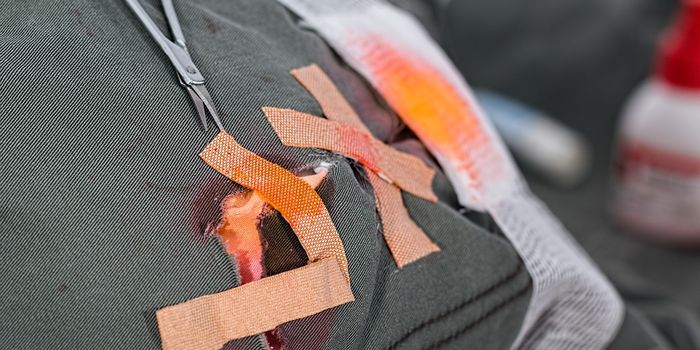 Dead Cells Release Wound Healing Signals