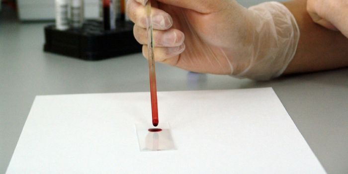 HIV: Third Case of Full Remission in a Child