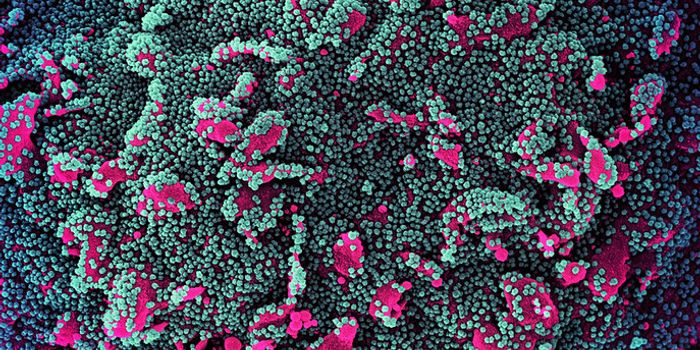 Are Autoantibodies to Blame for Long COVID?