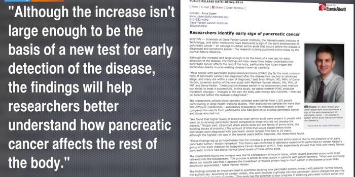 Scientists May Have Found An Early Sign Of Pancreatic Cancer