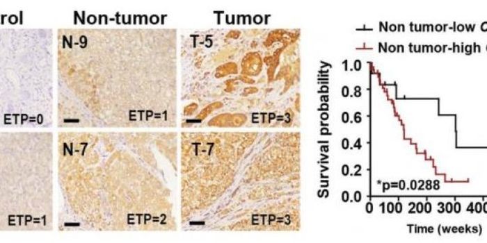 Therapeutic Avenues in Chronic Liver Disease