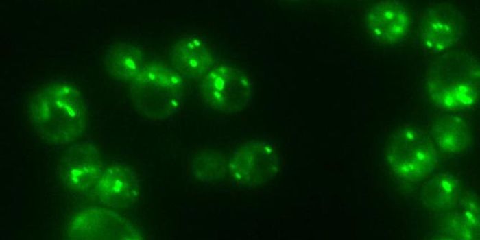 Enzyme That Regulates Fat Linked to Disease