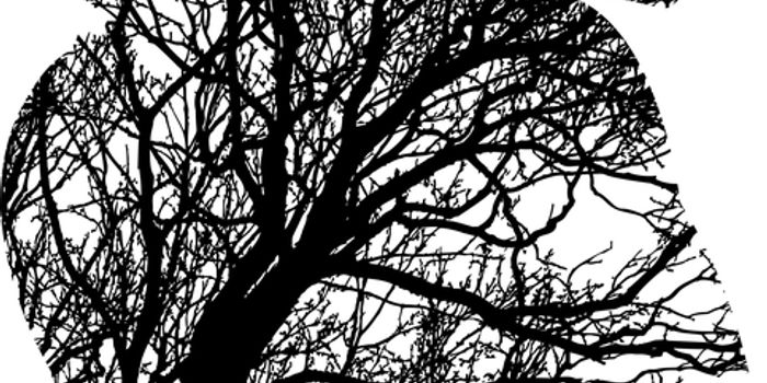 COVID-19 and the Heart- Insights from Cardiac Imaging