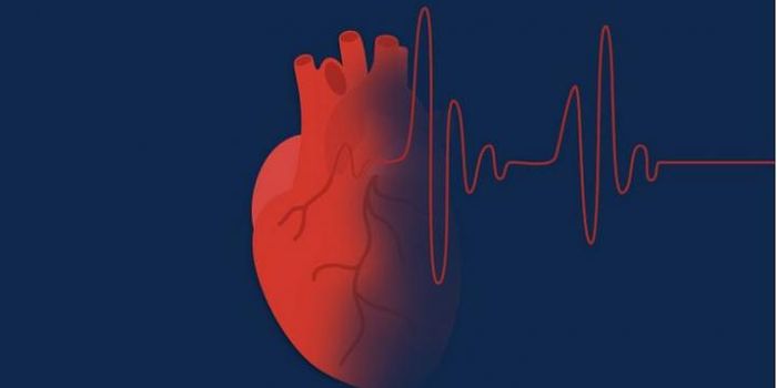 Stroke Prevention Methods Vital for Atrial Fibrillation Patients