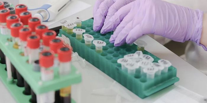 Crumpling Graphene Makes It an Ultra-Sensitive Biosensor