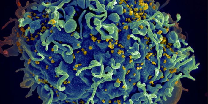 The Key to Exposing Hidden HIV Reservoirs Discovered