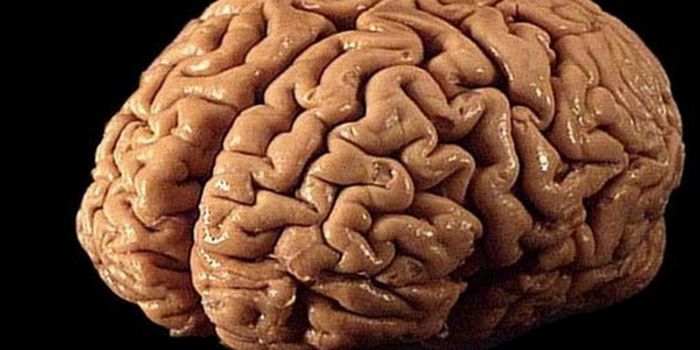 The Value of Brain Banks