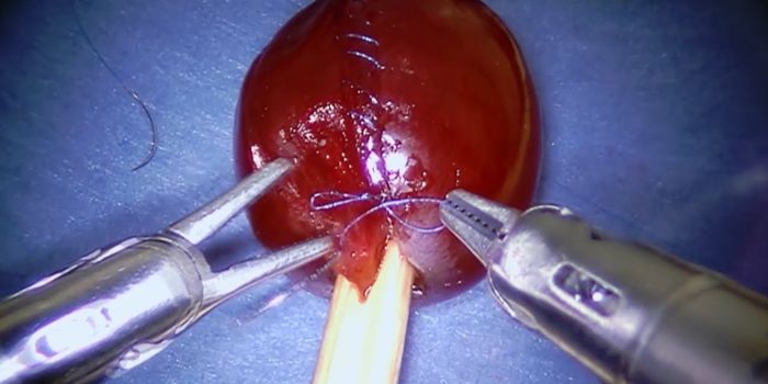 Watch This Surgical Robot Perform Stitches on a Grape