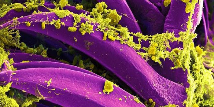 In a First, an mRNA Vaccine for a Deadly Bacterium is Created