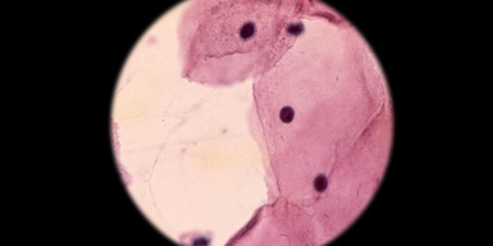 Effective Cervical Cancer Screening for Underserved Populations