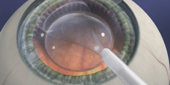 Injection Improves Corneal Transplant Outcomes