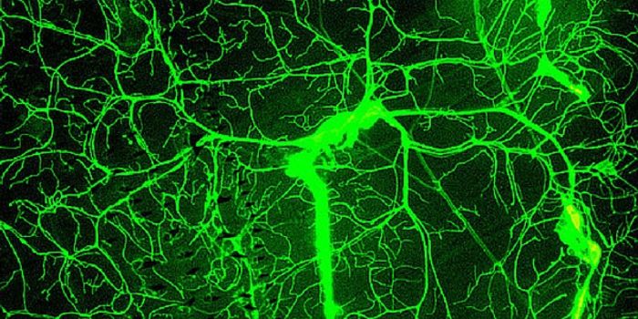 All About That Blood Brain Barrier