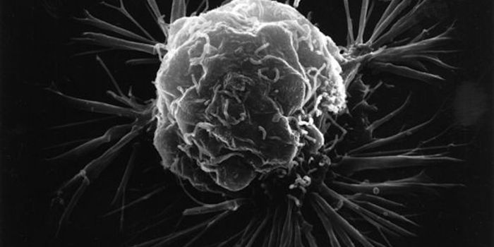 TSRI Scientists Find New Cancer Drug Target in Dual-Function Protein