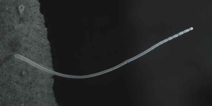 Giant Bacterium Challenges Our View of Microbes