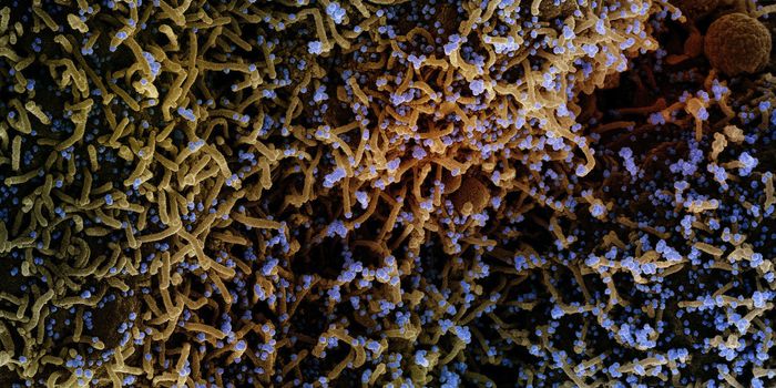 Some Neurodegenerative Diseases are More Likely After COVID-19