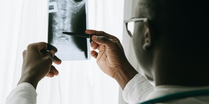 Routine Diagnostic Tests Linked to a 59 Percent Increase in Testicular Cancer Risk