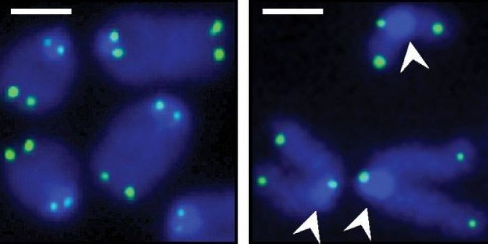 Protecting B Cell Chromosomes to Treat Non-Hodgkin's Lymphoma