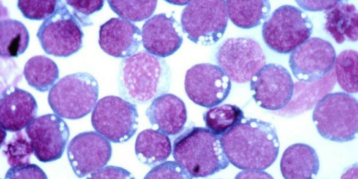 How a Cancer-Causing Virus Hides in Plain Sight