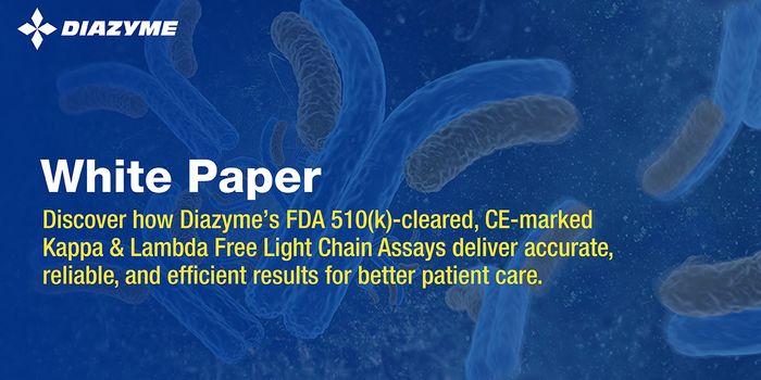 Serum Free Light Chain Assays in Clinical Practice